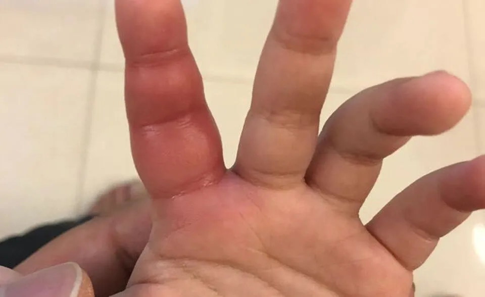 lubricante natural casero How Does The Pinky Finger Impact Freestyle Pull?